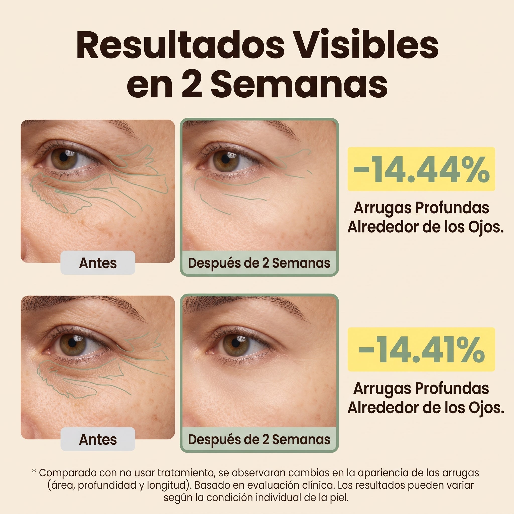 Lyria™ | PDRN Eye Shot (Todo en uno) | Con 12.000 Vibraciones + Colágeno