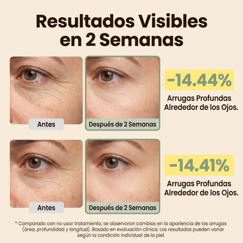 Lyria™ | PDRN Eye Shot (Todo en uno) | Con 12.000 Vibraciones + Colágeno