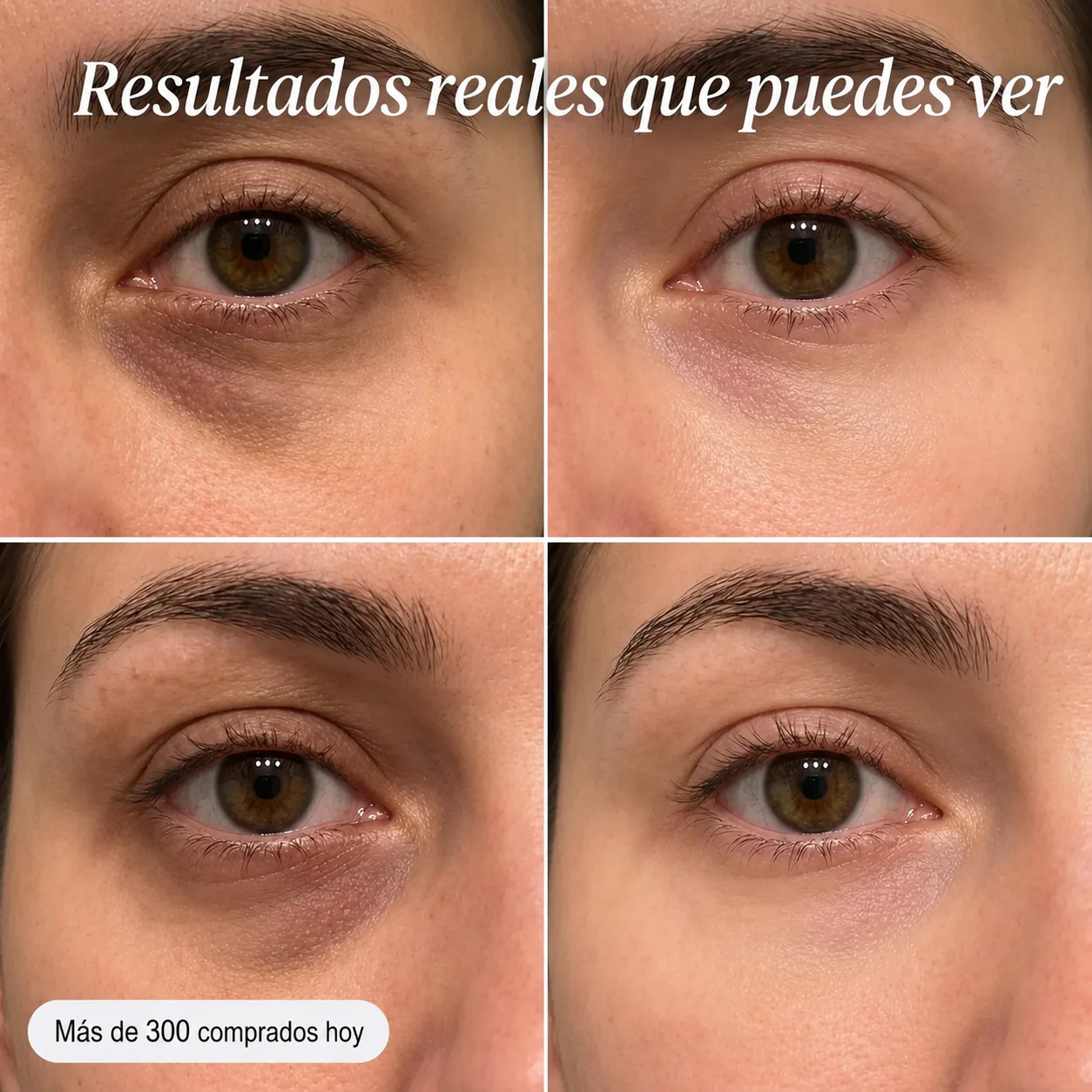 Lyria™ | PDRN Eye Shot (Todo en uno) | Con 12.000 Vibraciones + Colágeno