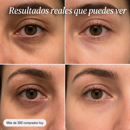 Lyria™ | PDRN Eye Shot (Todo en uno) | Con 12.000 Vibraciones + Colágeno